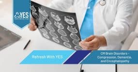 icd 10 code for dementia